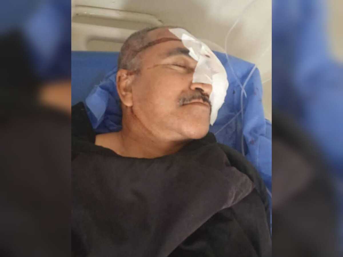 Docente recibió un disparo en la cara durante un atraco en Aguachica