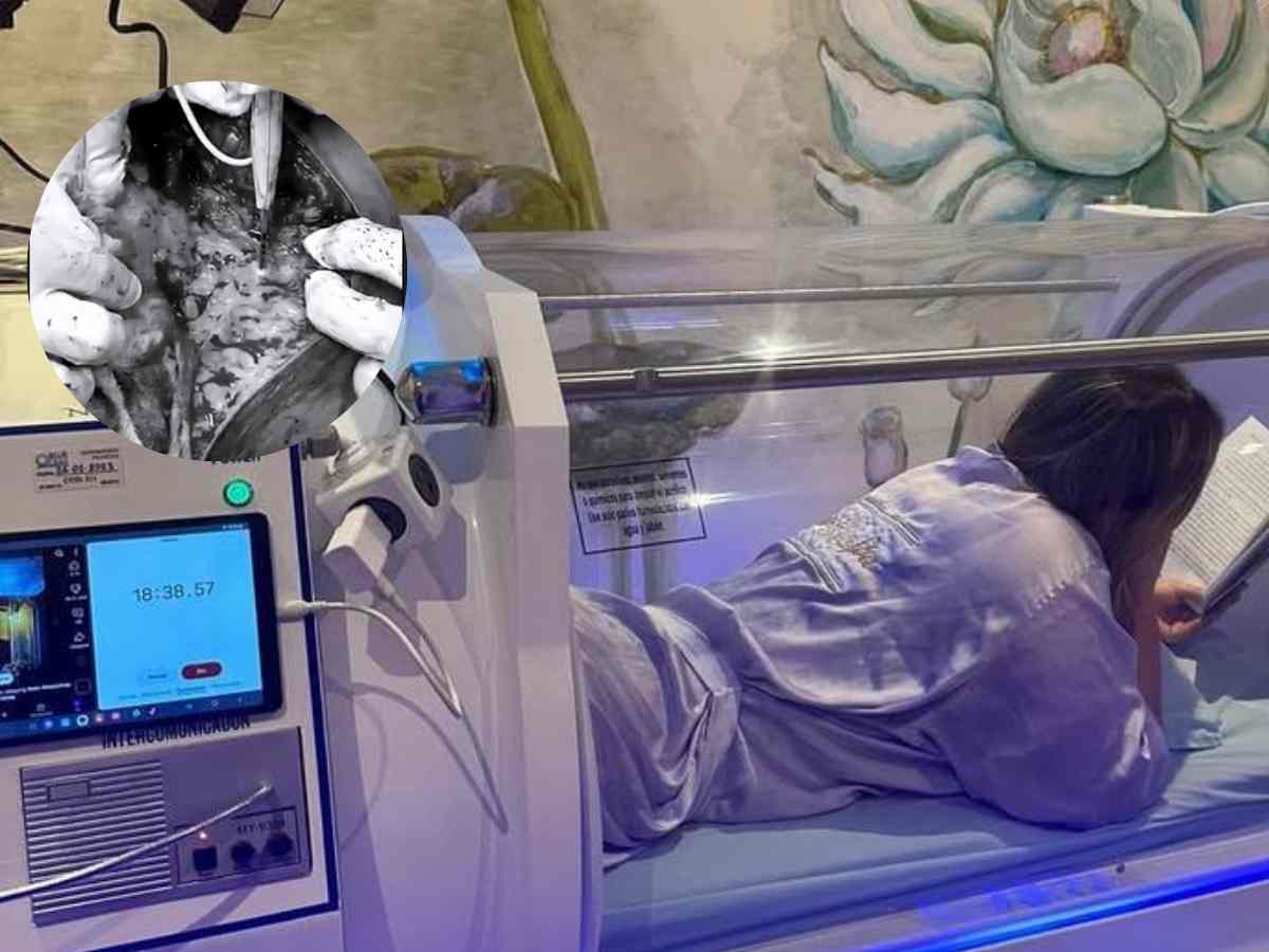 “Tenía una inflamación crónica”: Milagros Villamil relató su experiencia tras el retiro de biopolímeros