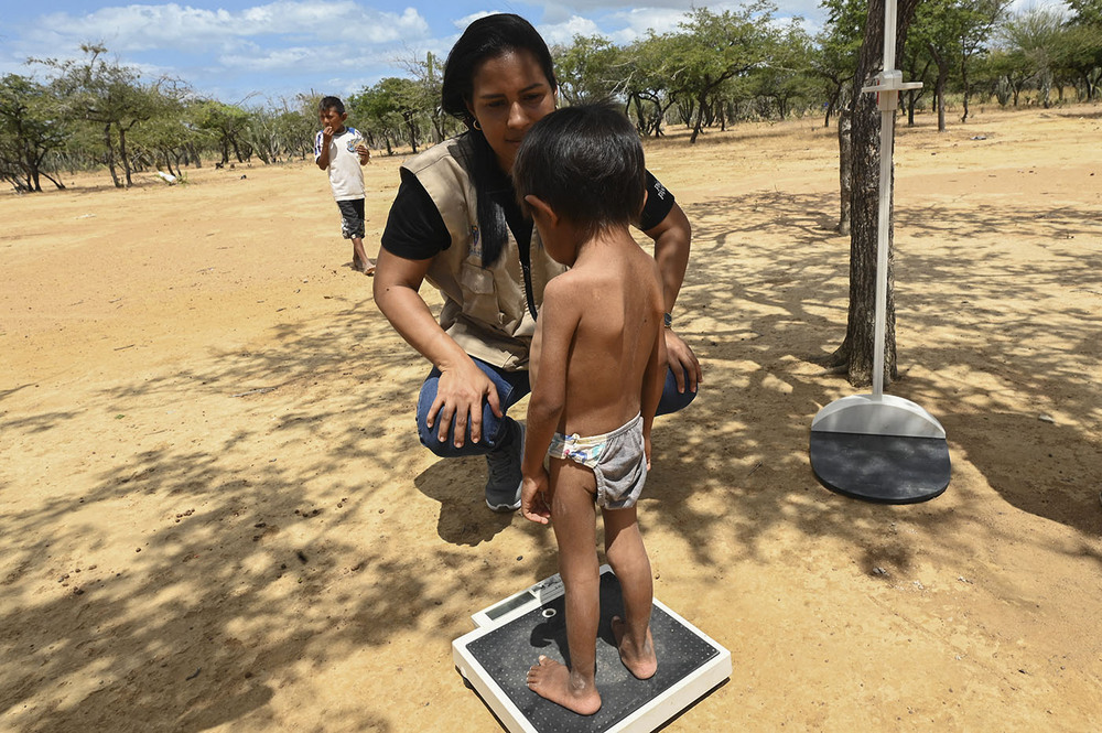 La desnutrición infantil en el Cesar tiene rostro indígena: el 75% de las muertes por desnutrición en menores de cinco años en 2024 correspondieron a niños de los pueblos Yukpa, Arhuaco, Kogui y Wayuu. Foto: JOAQUIN SARMIENTO / AFP