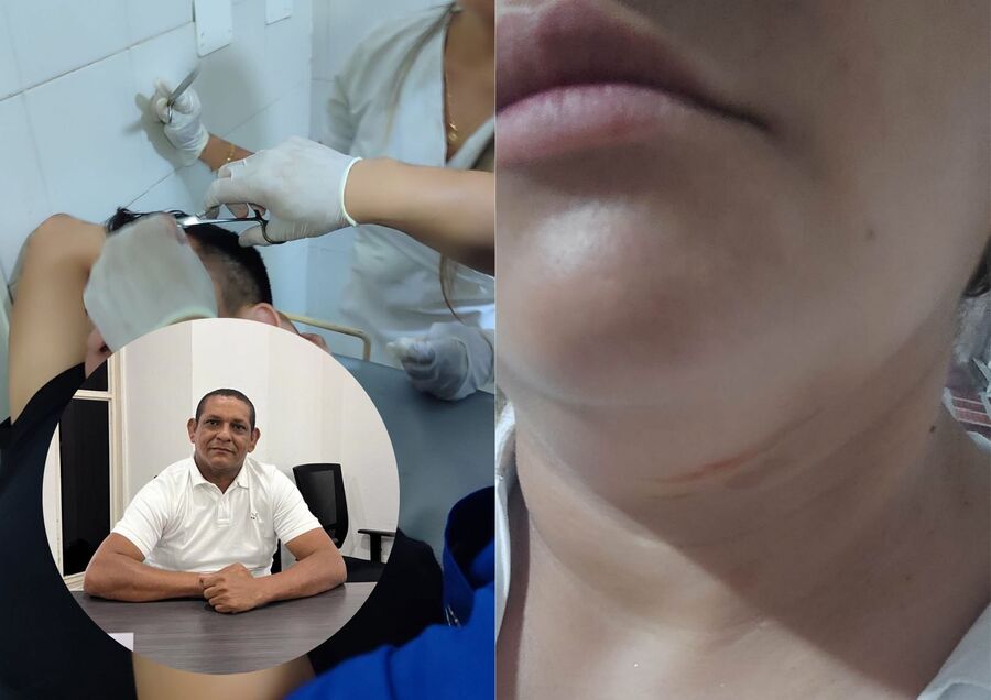 Mujer acusa a concejal de La Jagua de agredir a su esposo; él lo desmiente