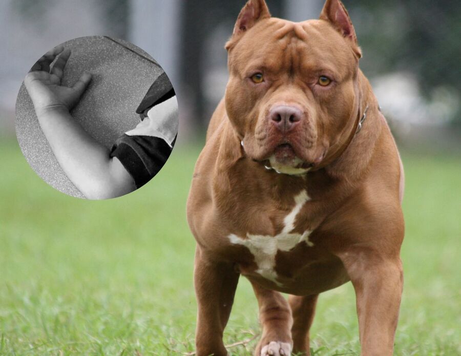 Tragedia en San Alberto, Cesar: niño de 2 años murió tras ataque de un perro pitbull