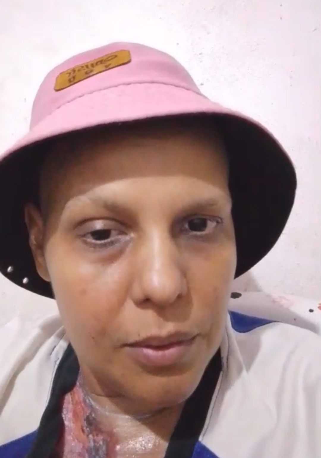 Ornella Álvarez, paciente oncológica. Foto: Cortesía.