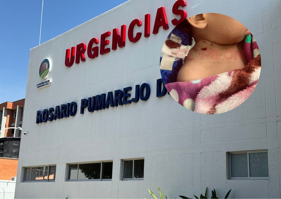 Niño de 5 años resultó herido por bala perdida en riña entre hinchas de América y Junior tras partido en Valledupar