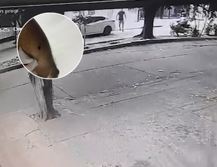 Policía resultó herido en medio de un hurto cerca del Comando en Valledupar