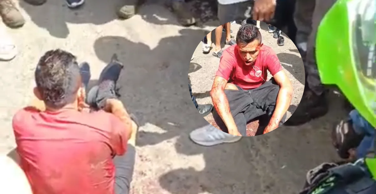 El intento de hurto ocurrió en el barrio Simón Bolívar y dejó dos personas heridas, entre ellas el presunto ladrón. Foto: cortesía.