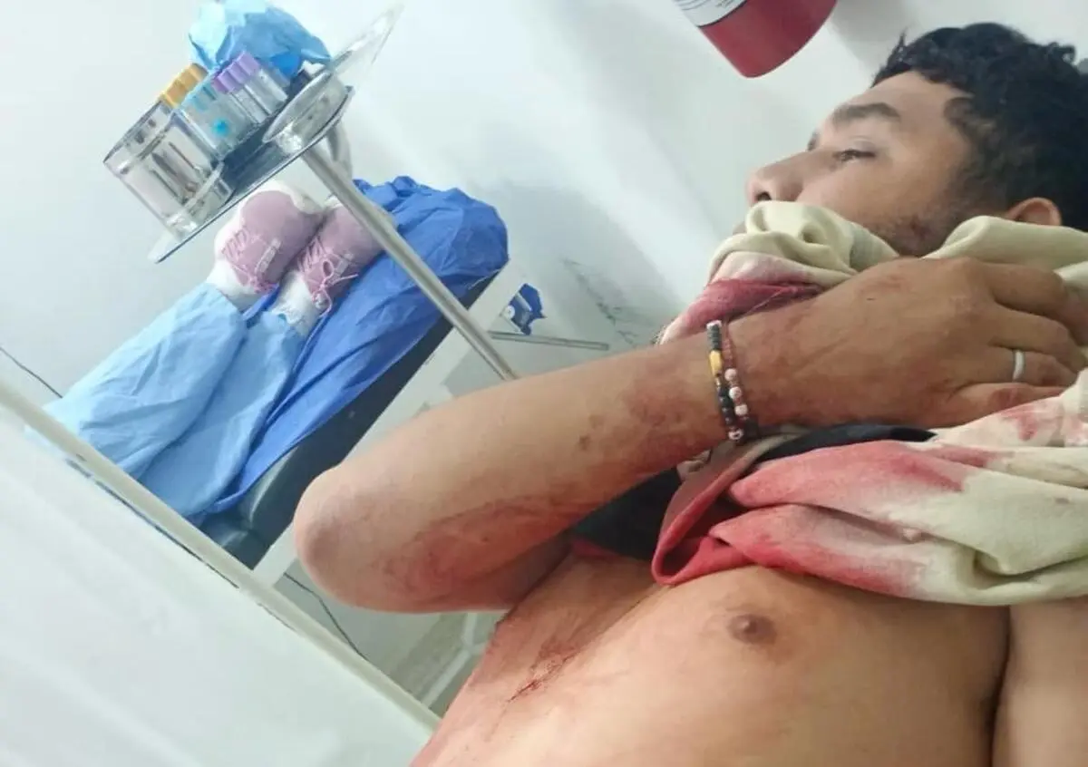 Según versiones extraoficiales, se trataría de unos “falsos mangueros” que se movilizaban en motocicleta cargando una varilla recolectora.