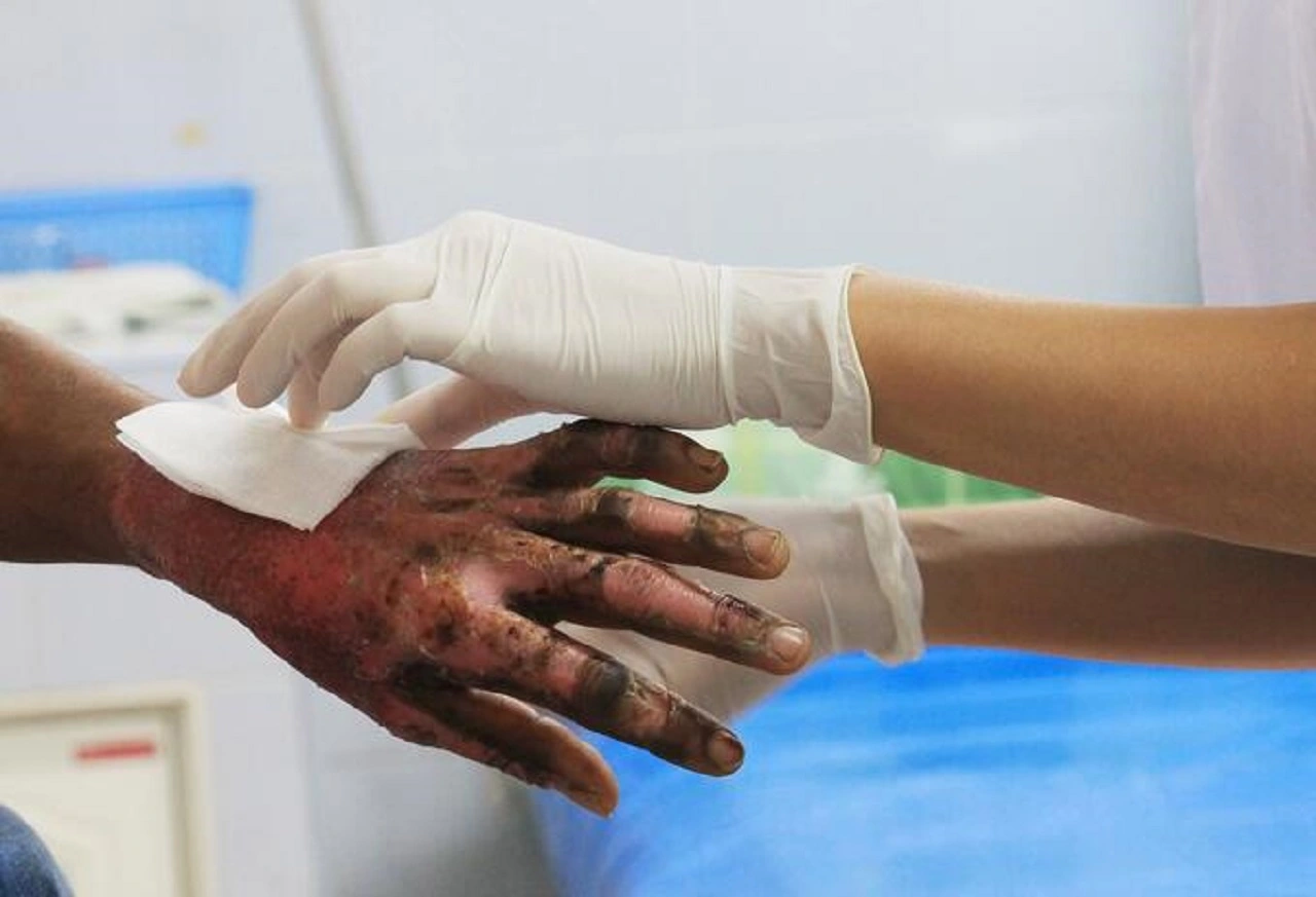 La ley es clara y obliga a todos los hospitales, públicos o privados, a atender de inmediato a niños lesionados por pólvora, sin importar tutores, dinero o cupos disponibles.