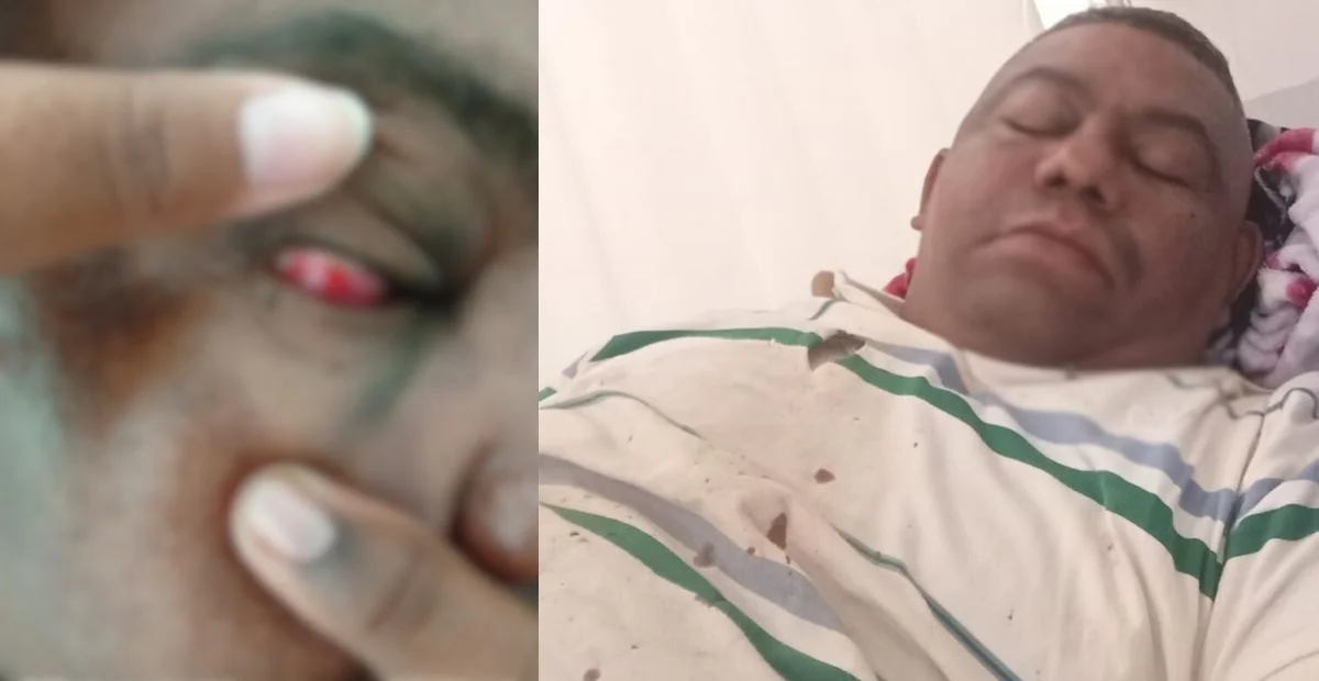 César Ahumada resultó herido en la comuna 5 de Valledupar y fue sometido a una cirugía. Foto: cortesía.