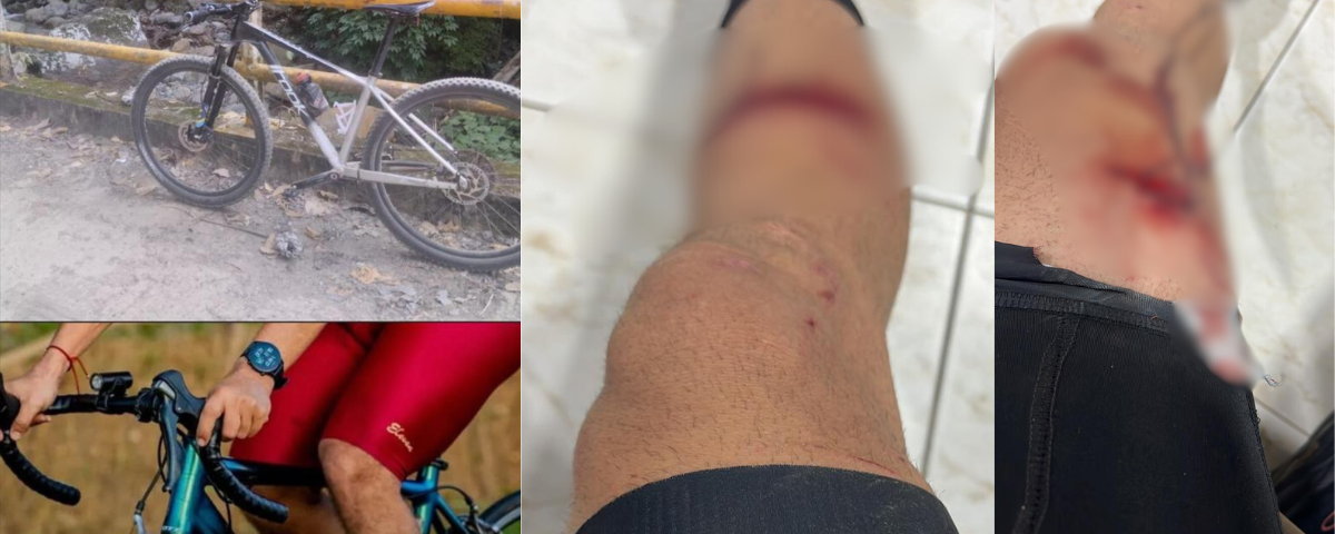 El caso ocurrió hacia las 5 de la mañana, en una vía que conecta a los departamentos del Cesar y La Guajira, un corredor frecuentado por deportistas.