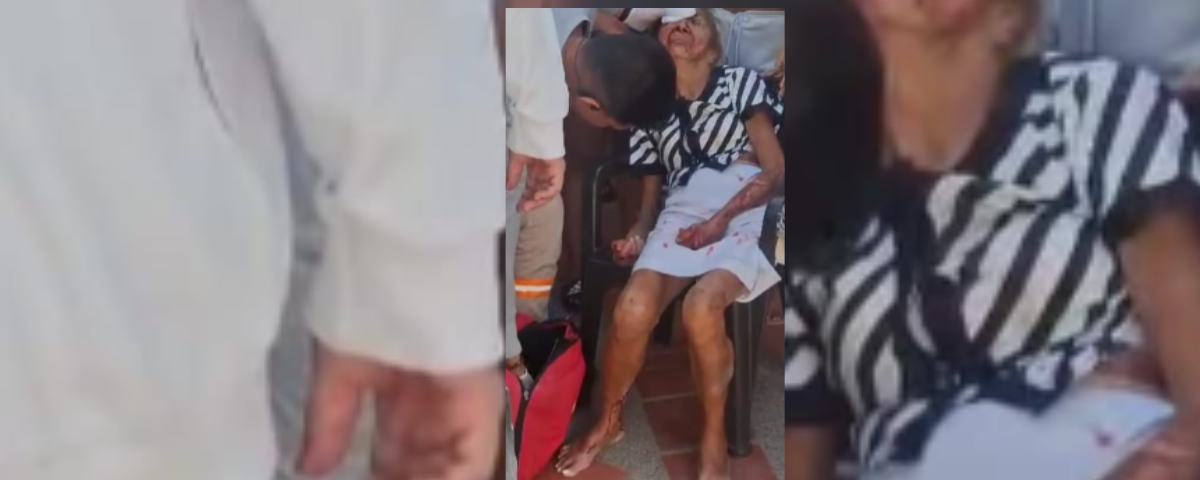 El triste final de Rocío de Jesús, la mujer de 73 años que murió arrollada por una moto en Valledupar: esto se sabe