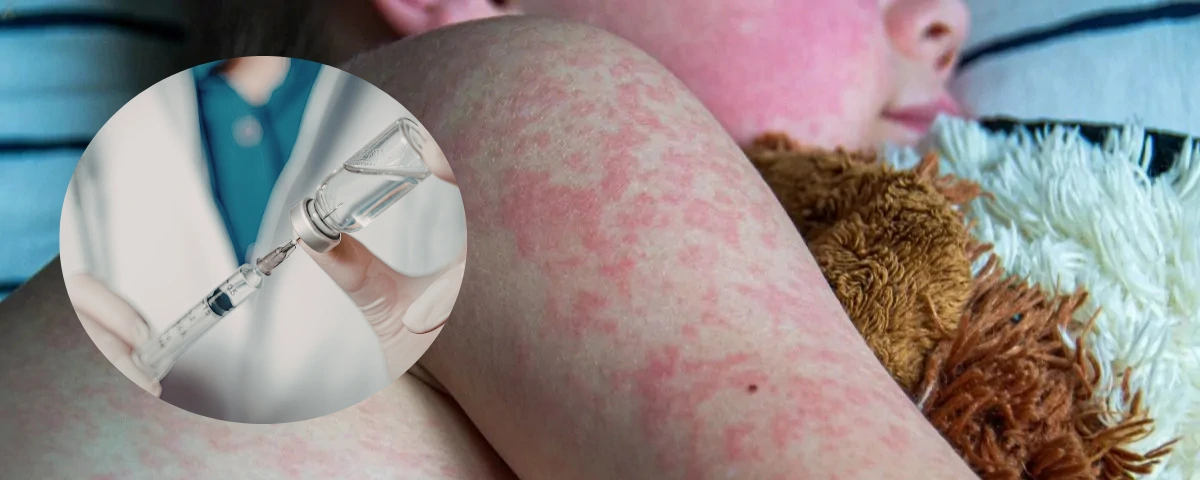 Los casos fueron confirmados por el ministro de Salud, Guillermo Alfonso Jaramillo.