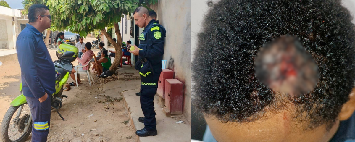 Trabajador de Afinia fue agredido con arma blanca durante inspección en Valledupar