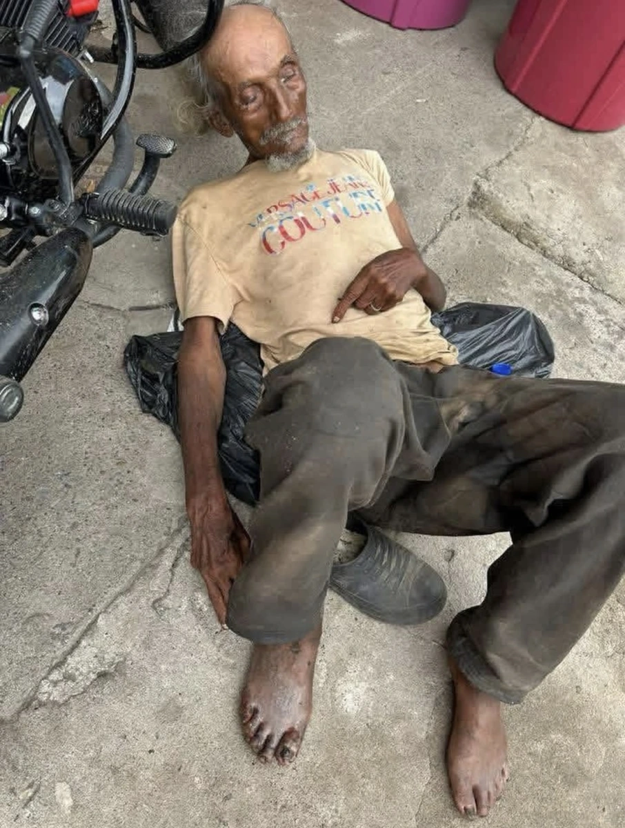 Ezequiel, un adulto mayor permanece tendido en el suelo, tras dos días a la intemperie en una calle de Valledupar, mientras las hormigas invaden sus piernas heridas bajo la mirada indiferente de quienes pasan cerca. Foto: Cortesía.