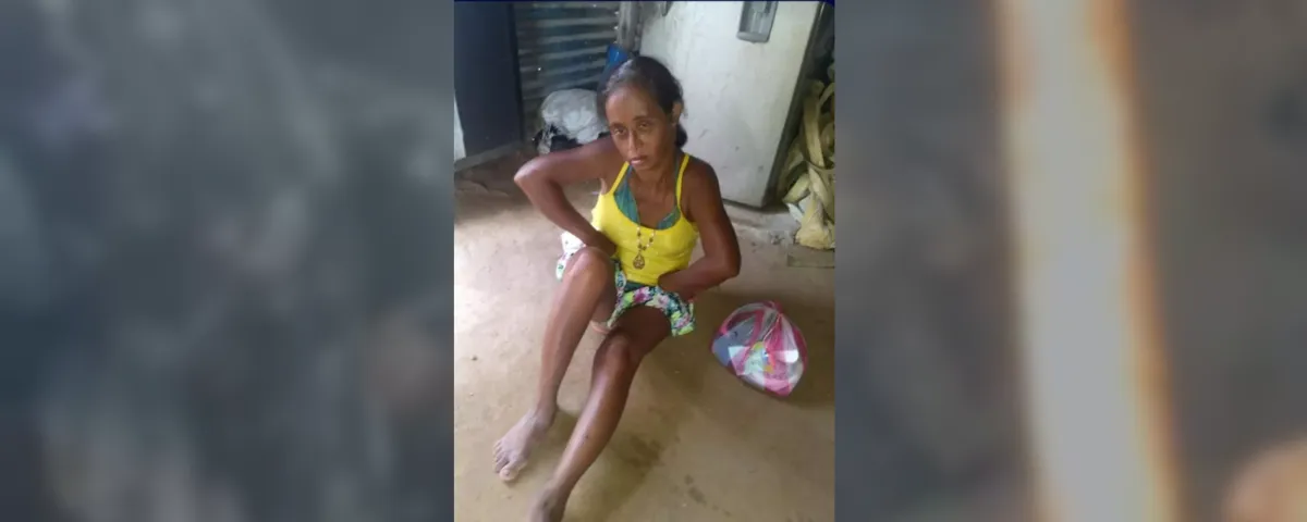 Triste despedida a Yaneth Perdomo, la mujer con síndrome de Down que murió en un incendio en El Paso, Cesar