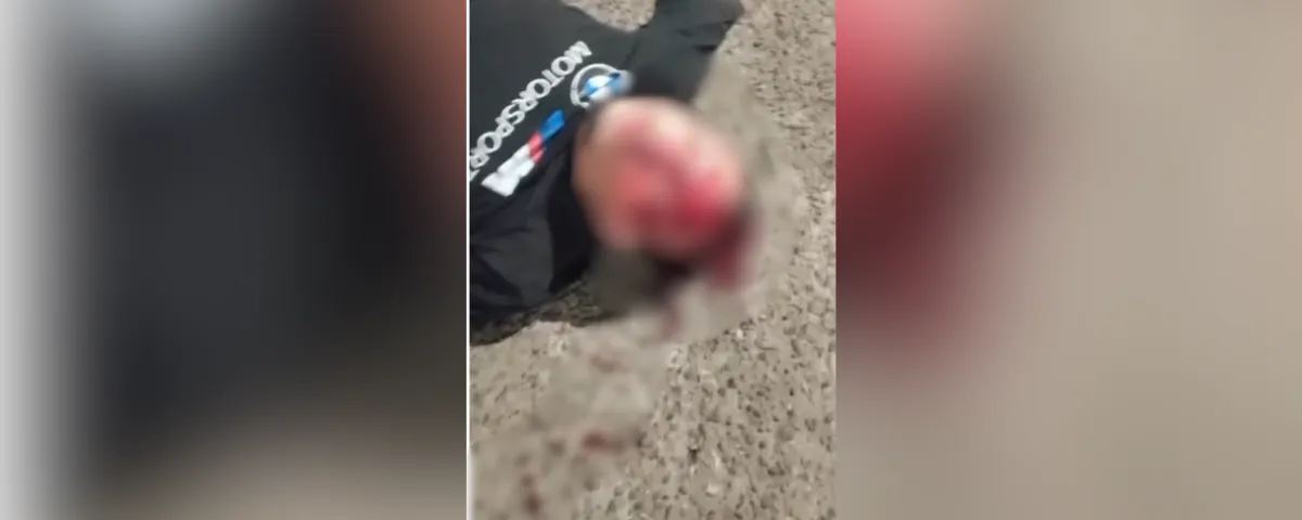 Tras lo ocurrido, el motociclista fue auxiliado y trasladado a la Clínica Alta Complejidad de Valledupar, donde permanece bajo atención médica.