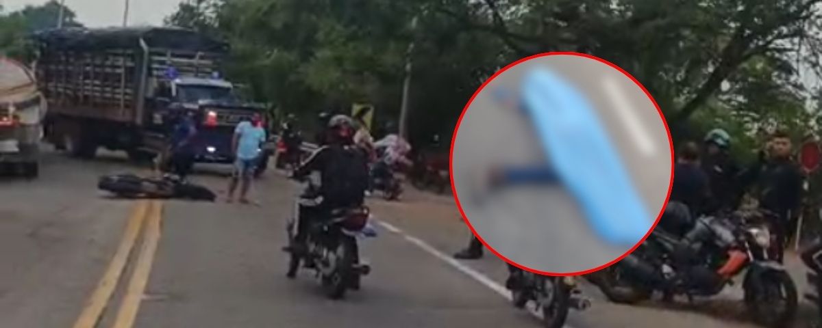Motociclista murió tras chocar contra una volqueta en la vía Valledupar-La Paz