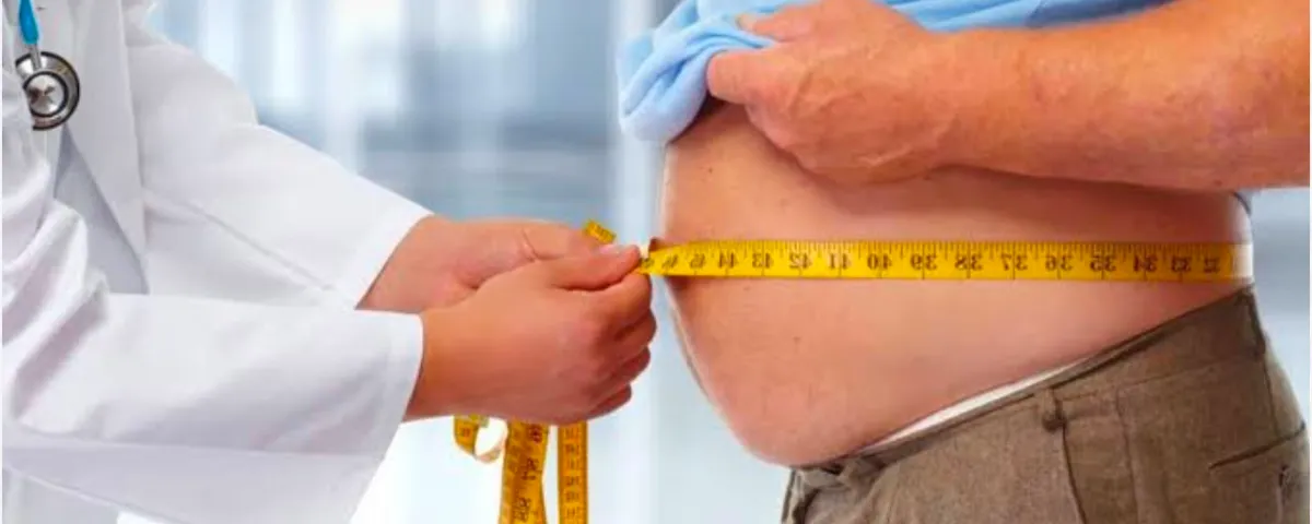 Cirugía bariátrica en personas en estado de obesidad