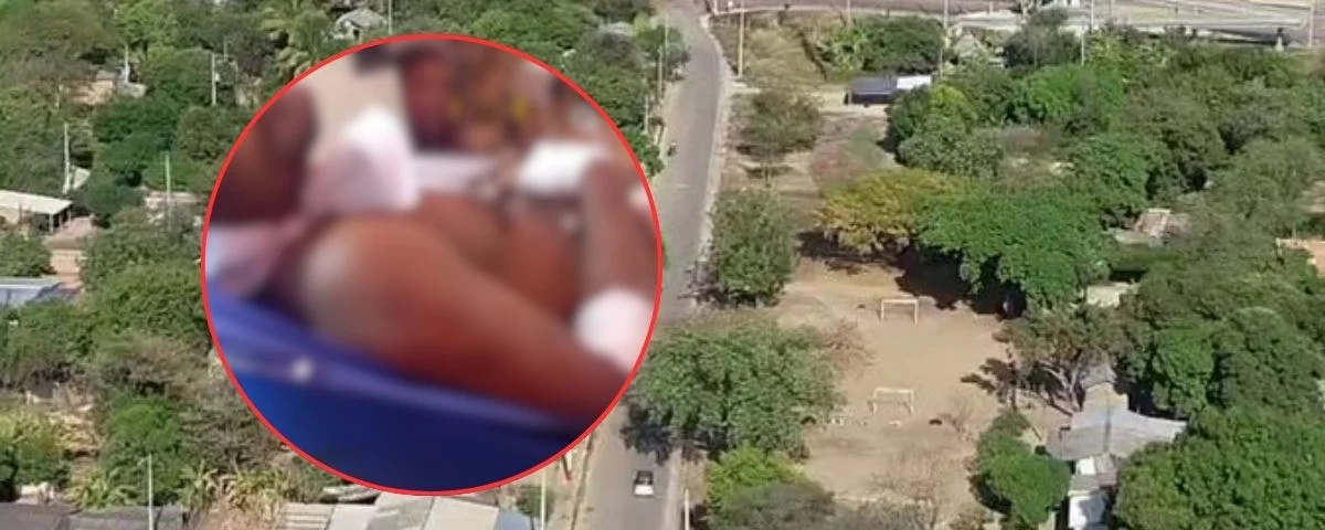 Ataque a bala en Mariangola dejó a un joven gravemente herido: fue trasladado a Valledupar