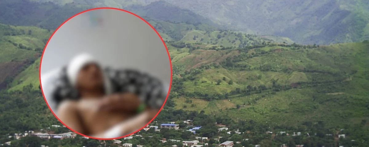 Ataque a bala en La Paz, Cesar: hombre de 32 años recibió un disparo en una finca